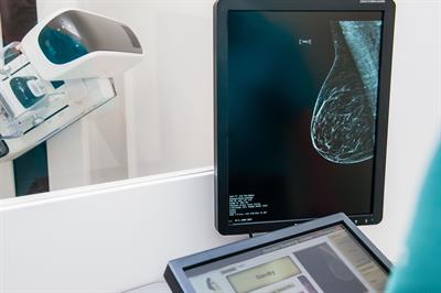 Mammography equipment